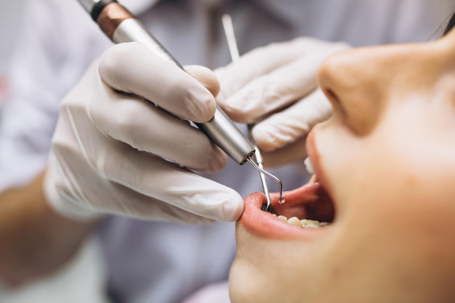 Şişli Endodonti Uzmanı: Kanal Tedavisi Gerçekten Ağrılı Bir İşlem mi?